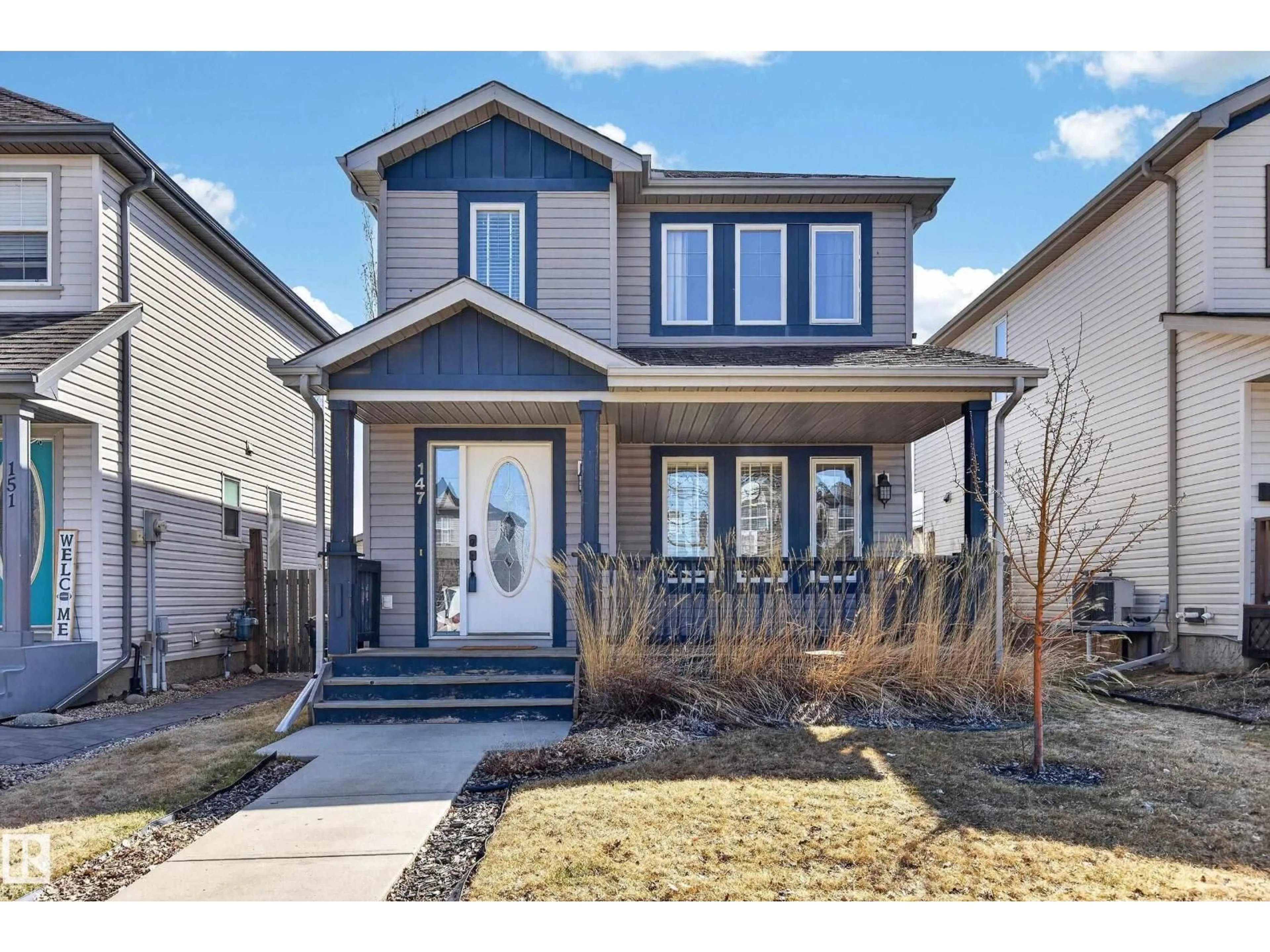 Unknown for 147 SUMMERWOOD DR, Sherwood Park Alberta T8H0B3