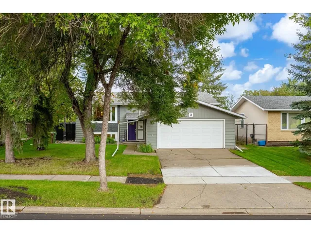 3 AKINS DR, St. Albert 2