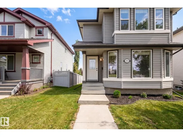 404 HEMINGWAY RD, Edmonton 3