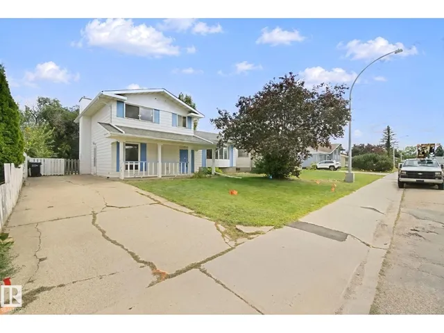 NW - 8807 181 ST, Edmonton 3