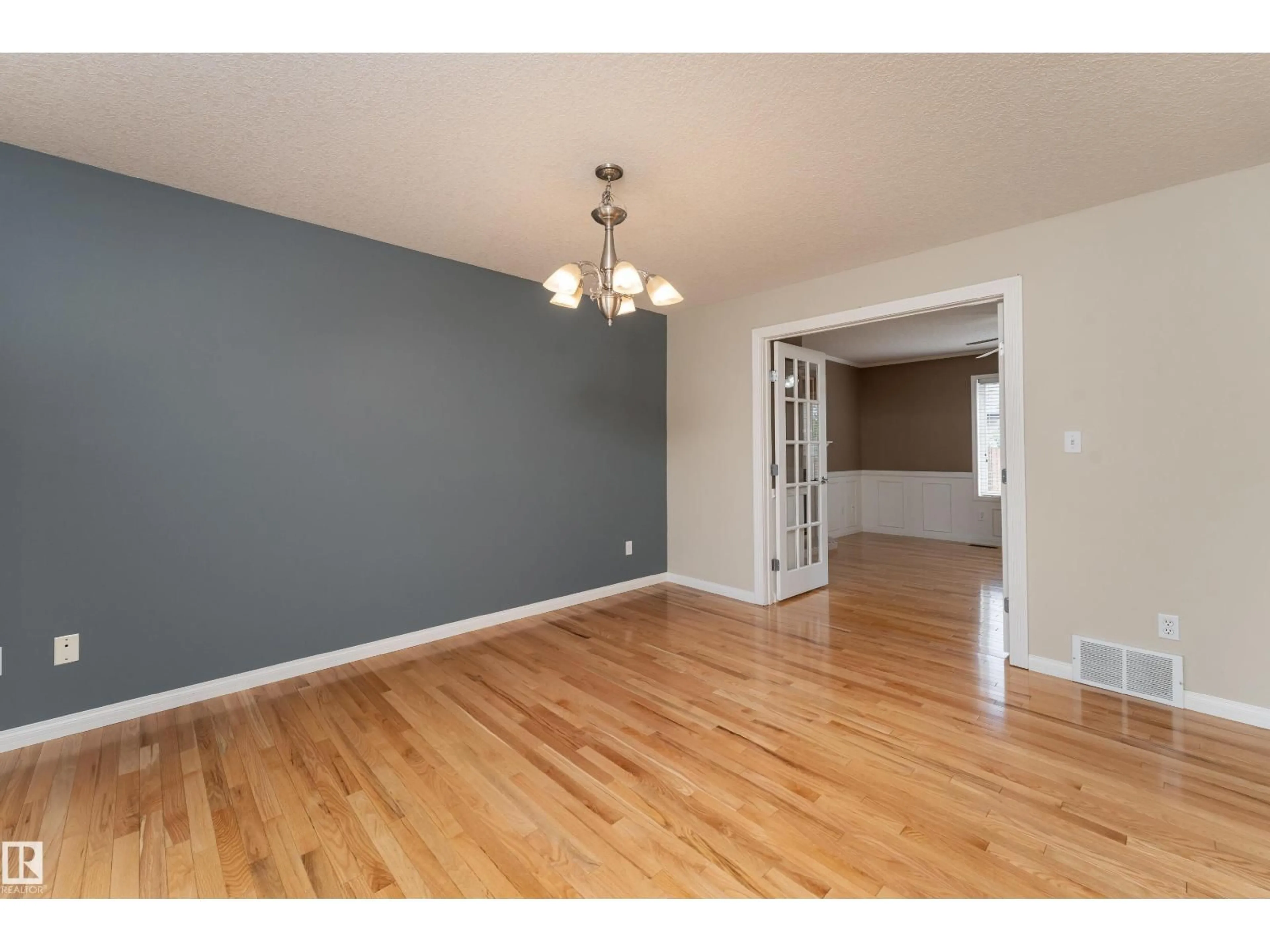 Unknown for 55 CATALINA DR, Sherwood Park Alberta T8H2B4